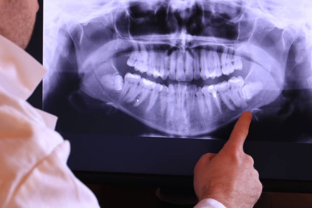 Best Emergency Treatment for Toothache in Weweantic, MA